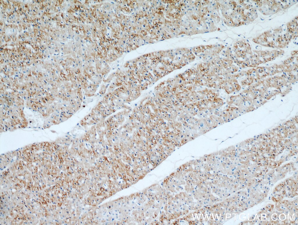 Immunohistochemistry (IHC) staining of human heart tissue using Connexin-43 Polyclonal antibody (15386-1-AP)