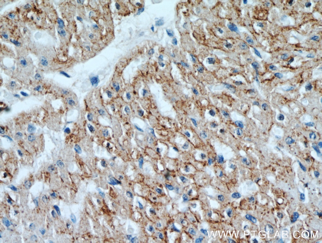 Immunohistochemistry (IHC) staining of human heart tissue using Connexin-43 Polyclonal antibody (15386-1-AP)