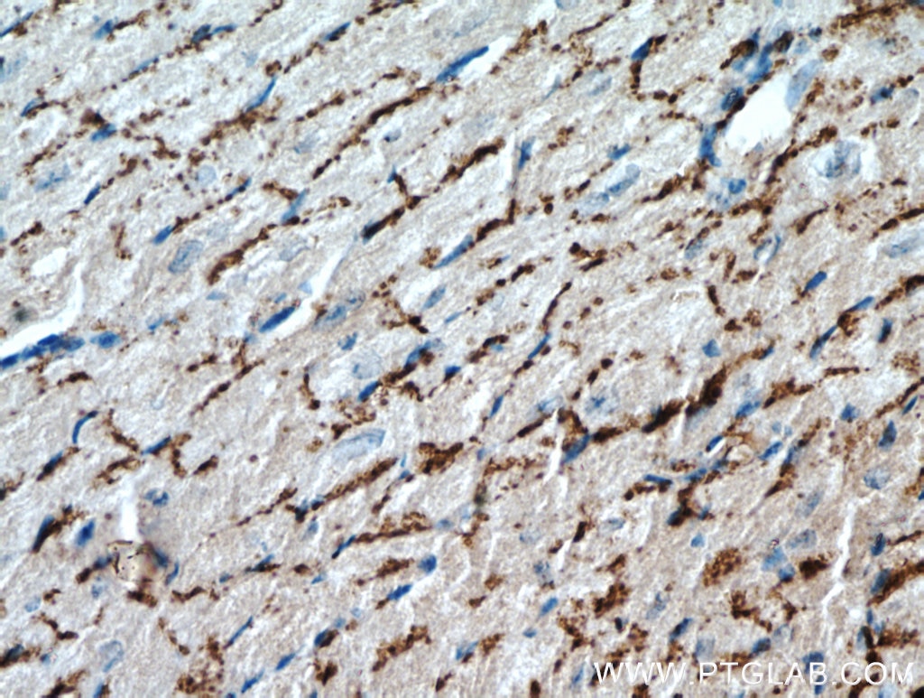 Connexin-43 Polyclonal antibody