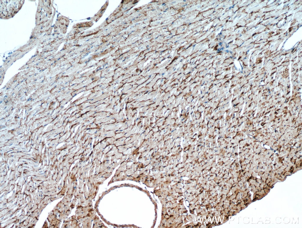 Immunohistochemistry (IHC) staining of mouse heart tissue using Connexin-43 Polyclonal antibody (15386-1-AP)