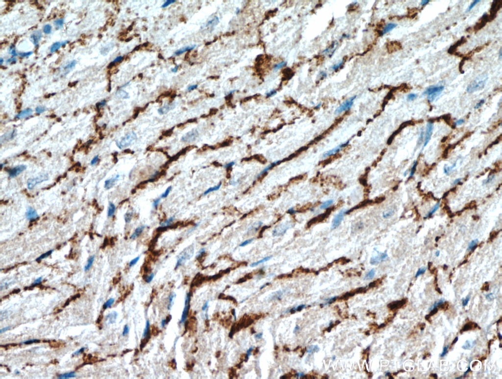 Immunohistochemistry (IHC) staining of mouse heart tissue using Connexin-43 Polyclonal antibody (15386-1-AP)