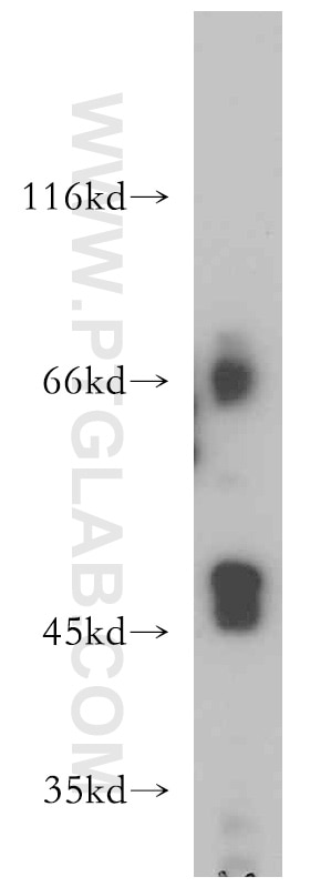 Western Blot (WB) analysis of HeLa cells using Connexin-43 Polyclonal antibody (15386-1-AP)
