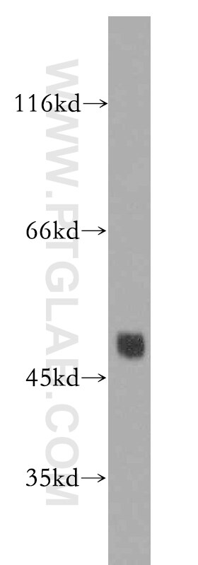 Western Blot (WB) analysis of human brain tissue using Connexin-46 Polyclonal antibody (19756-1-AP)