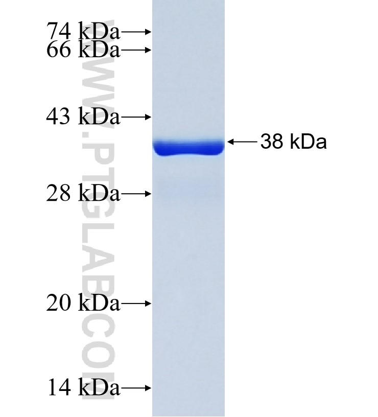 GJA5 fusion protein Ag24199 SDS-PAGE