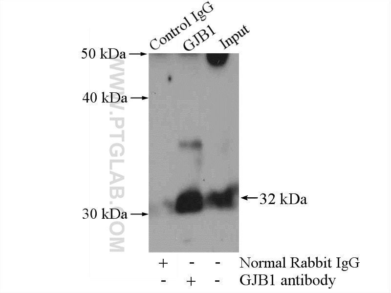Immunoprecipitation (IP) experiment of mouse brain tissue using Connexin-32 Polyclonal antibody (10450-1-AP)