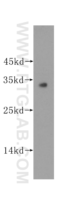 Western Blot (WB) analysis of human liver tissue using Connexin-32 Polyclonal antibody (10450-1-AP)