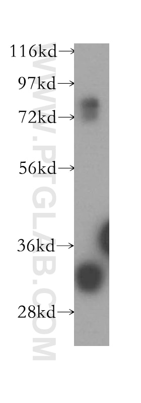 Western Blot (WB) analysis of A375 cells using Connexin-32 Polyclonal antibody (10450-1-AP)