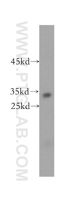 Western Blot (WB) analysis of mouse skin tissue using Connexin-32 Polyclonal antibody (10450-1-AP)