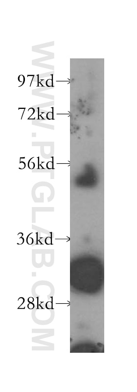 Western Blot (WB) analysis of mouse skin tissue using Connexin-32 Polyclonal antibody (10450-1-AP)