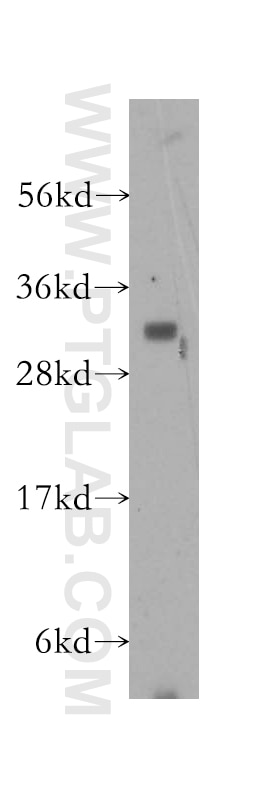 Western Blot (WB) analysis of mouse brain tissue using Connexin-32 Polyclonal antibody (10450-1-AP)