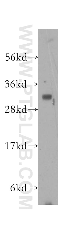 WB analysis of mouse brain using 10450-1-AP