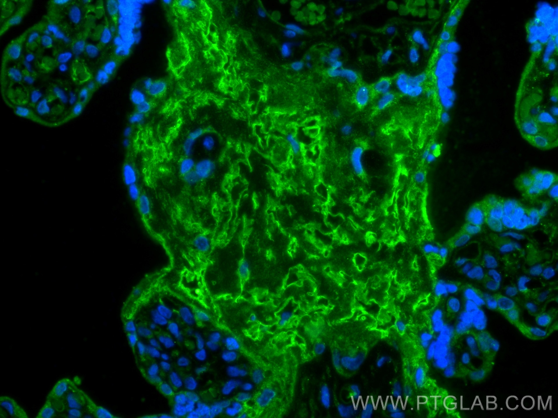 Immunofluorescence (IF) / fluorescent staining of human placenta tissue using GJB3 Polyclonal antibody (12880-1-AP)