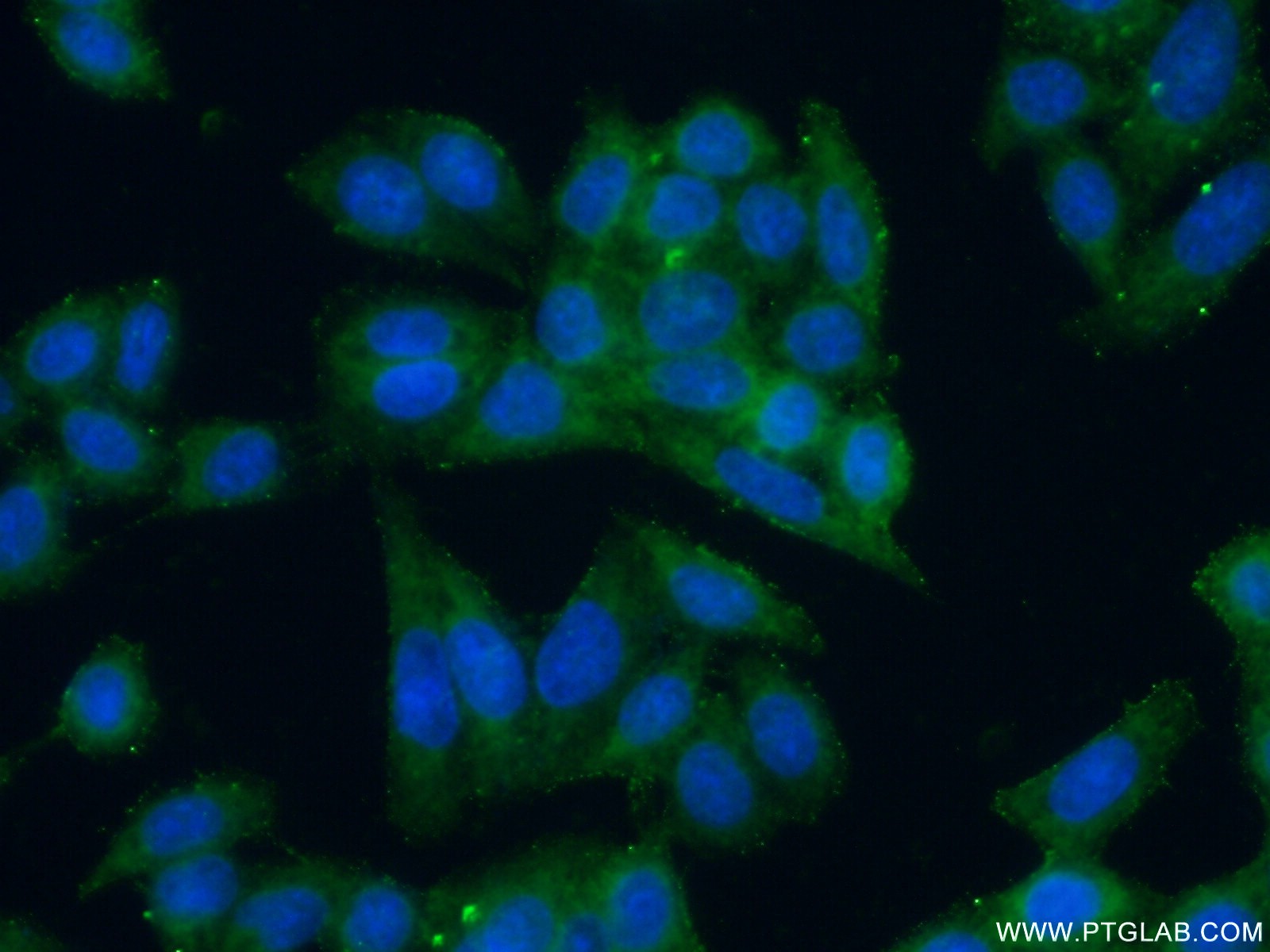 Immunofluorescence (IF) / fluorescent staining of HeLa cells using GJB3 Polyclonal antibody (12880-1-AP)