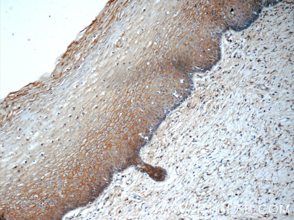 Immunohistochemistry (IHC) staining of human cervix tissue using GJB3 Polyclonal antibody (12880-1-AP)