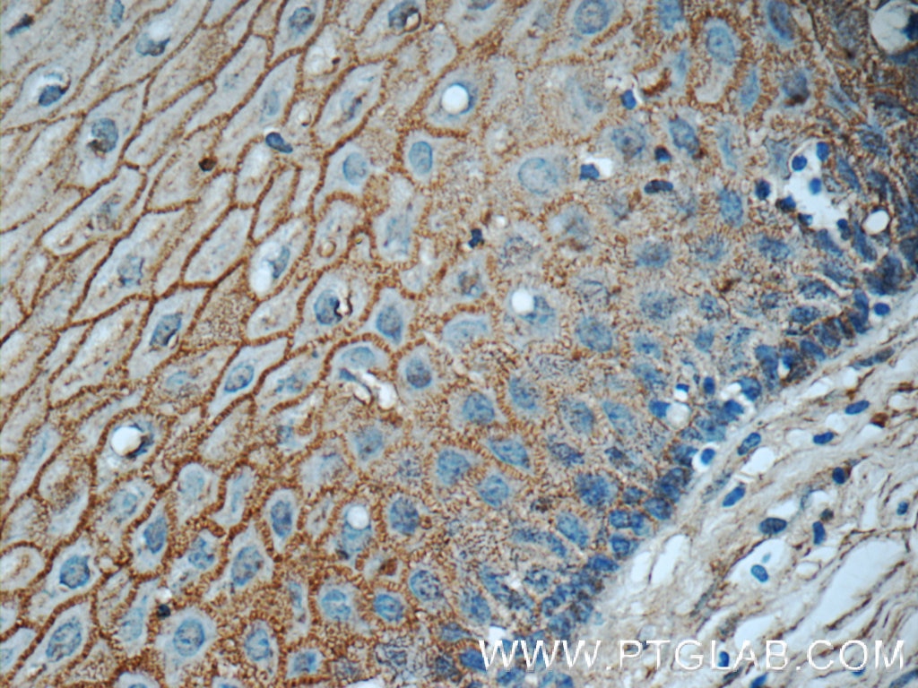IHC staining of human cervix using 12880-1-AP