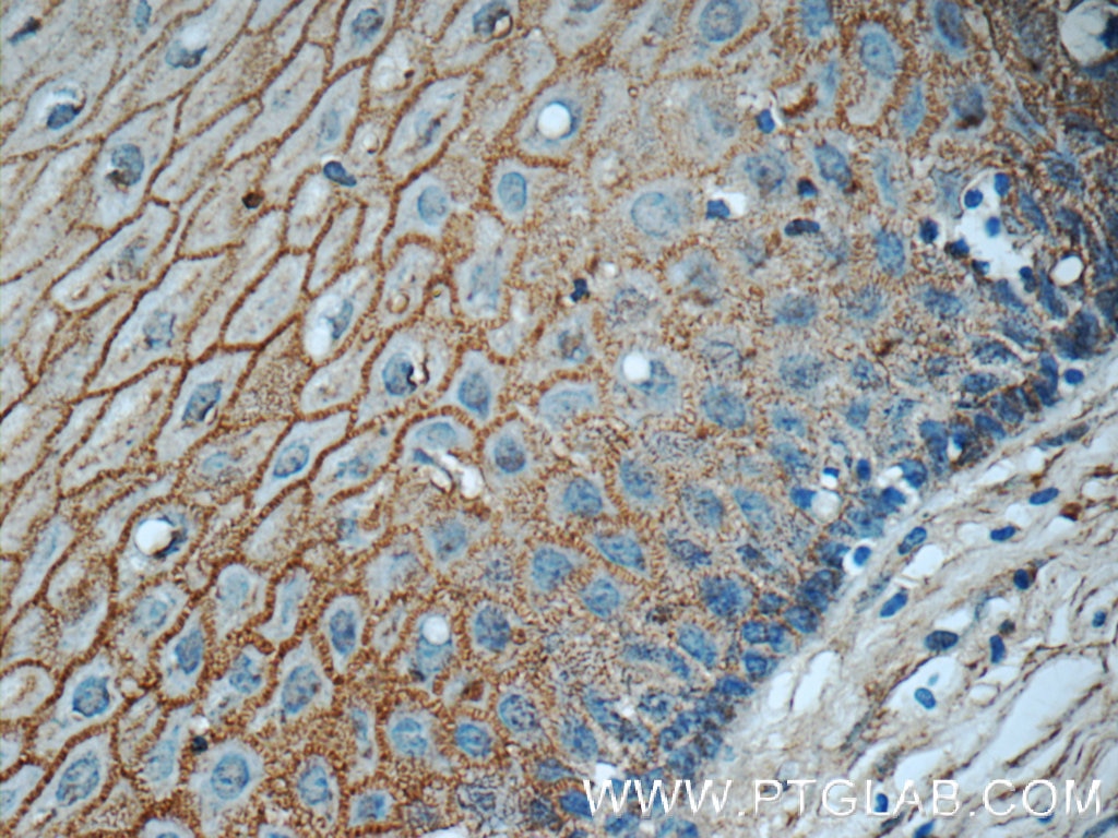 Immunohistochemistry (IHC) staining of human cervix tissue using GJB3 Polyclonal antibody (12880-1-AP)