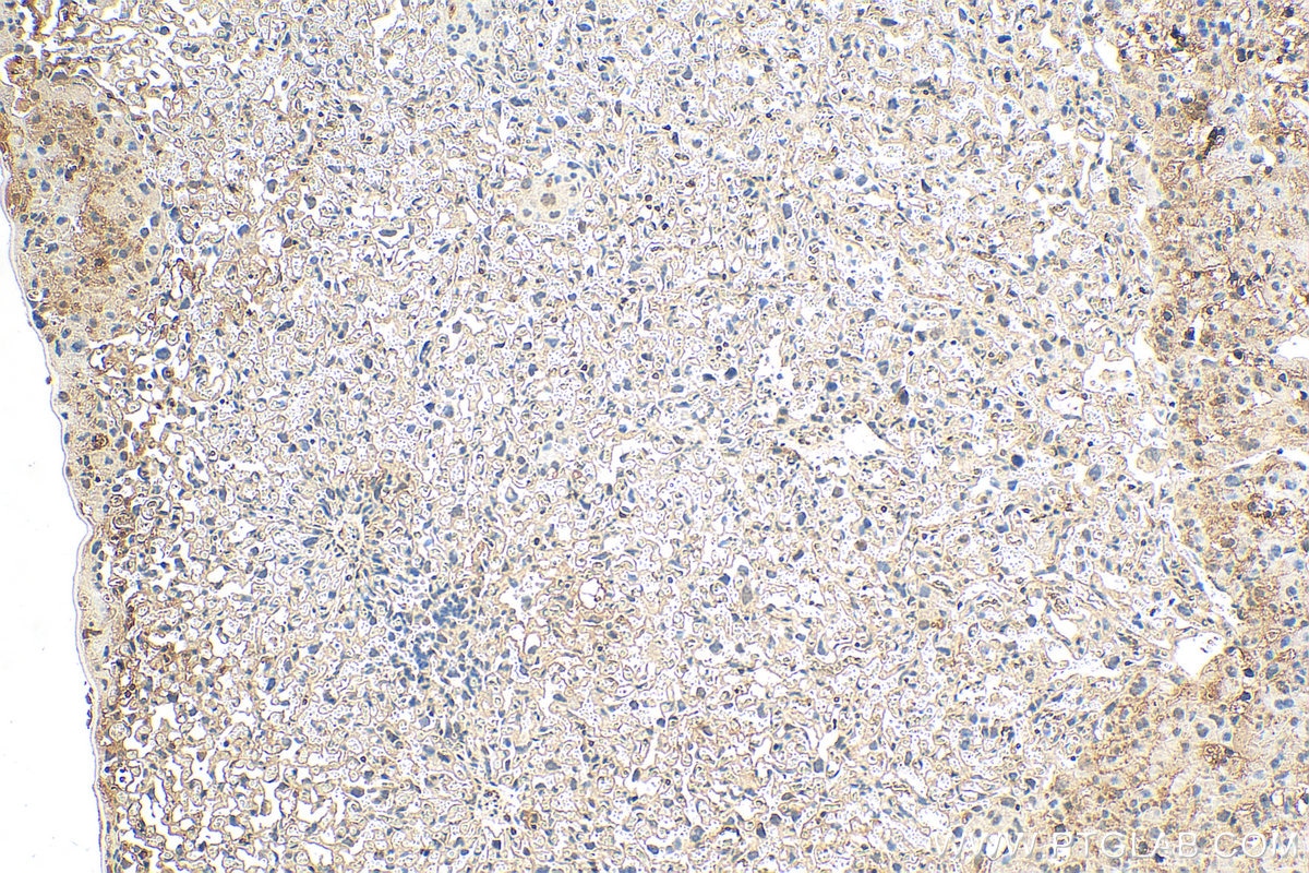 Immunohistochemistry (IHC) staining of mouse placenta tissue using GJB3 Polyclonal antibody (12880-1-AP)