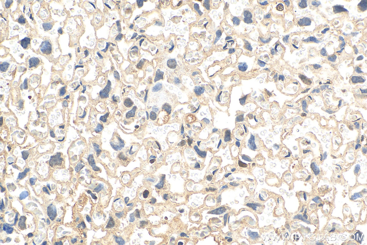 Immunohistochemistry (IHC) staining of mouse placenta tissue using GJB3 Polyclonal antibody (12880-1-AP)