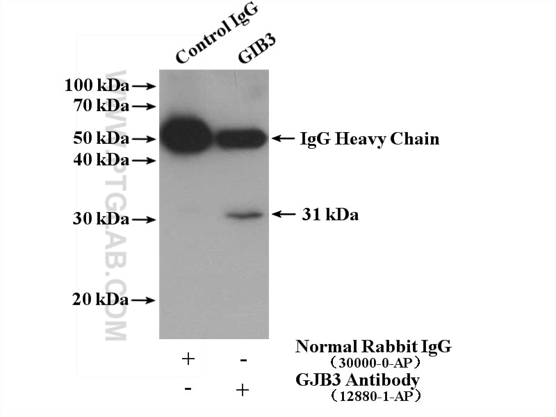 Immunoprecipitation (IP) experiment of HeLa cells using GJB3 Polyclonal antibody (12880-1-AP)