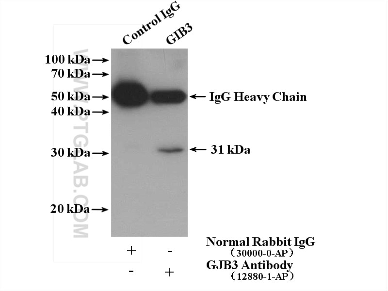 IP experiment of HeLa using 12880-1-AP