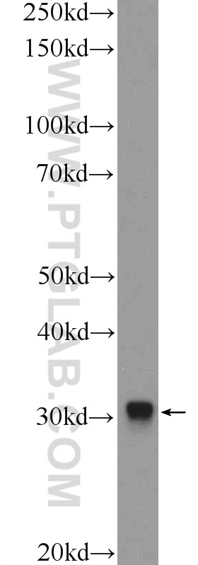 Western Blot (WB) analysis of HeLa cells using GJB3 Polyclonal antibody (12880-1-AP)