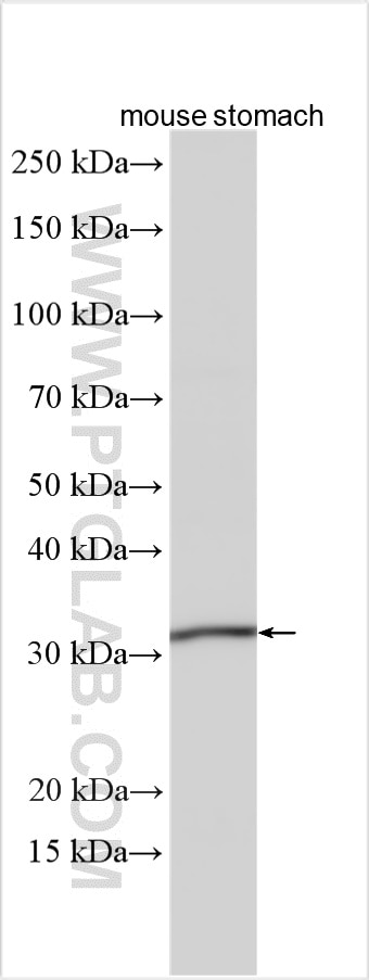 Western Blot (WB) analysis of various lysates using GJB3 Polyclonal antibody (12880-1-AP)