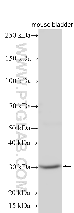 Western Blot (WB) analysis of various lysates using GJB3 Polyclonal antibody (12880-1-AP)