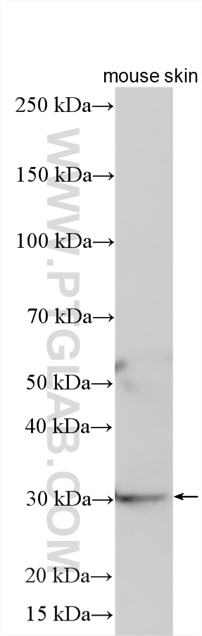 Western Blot (WB) analysis of various lysates using GJB3 Polyclonal antibody (12880-1-AP)