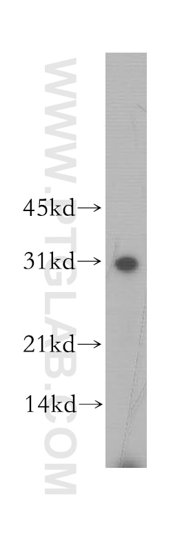 Western Blot (WB) analysis of human brain tissue using GJB3 Polyclonal antibody (12880-1-AP)