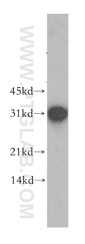 Western Blot (WB) analysis of human heart tissue using GJB3 Polyclonal antibody (12880-1-AP)