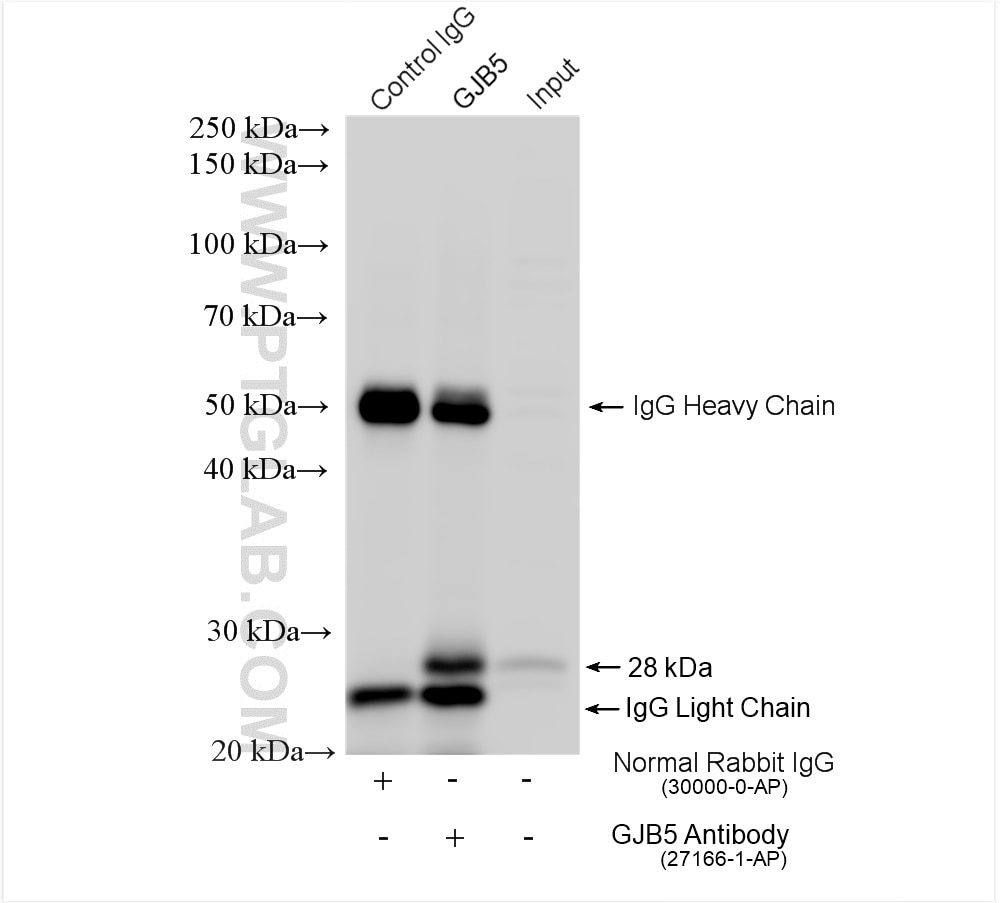 Immunoprecipitation (IP) experiment of mouse skin tissue using GJB5 Polyclonal antibody (27166-1-AP)