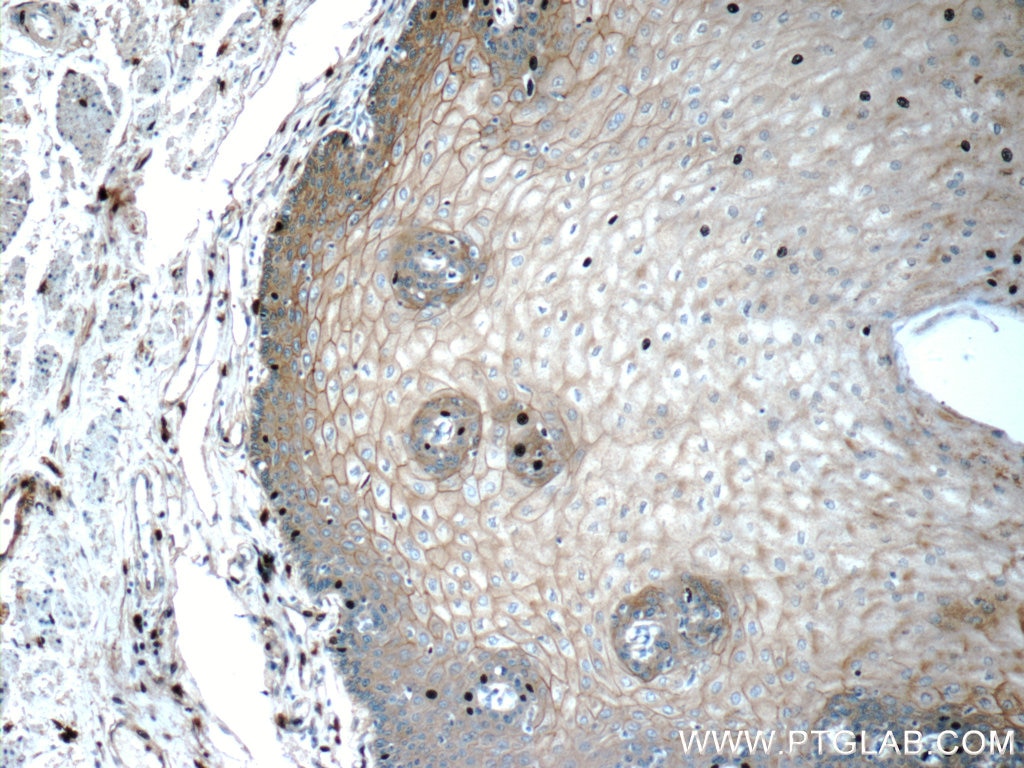 Immunohistochemistry (IHC) staining of human oesophagus tissue using GJB6 Polyclonal antibody (24215-1-AP)