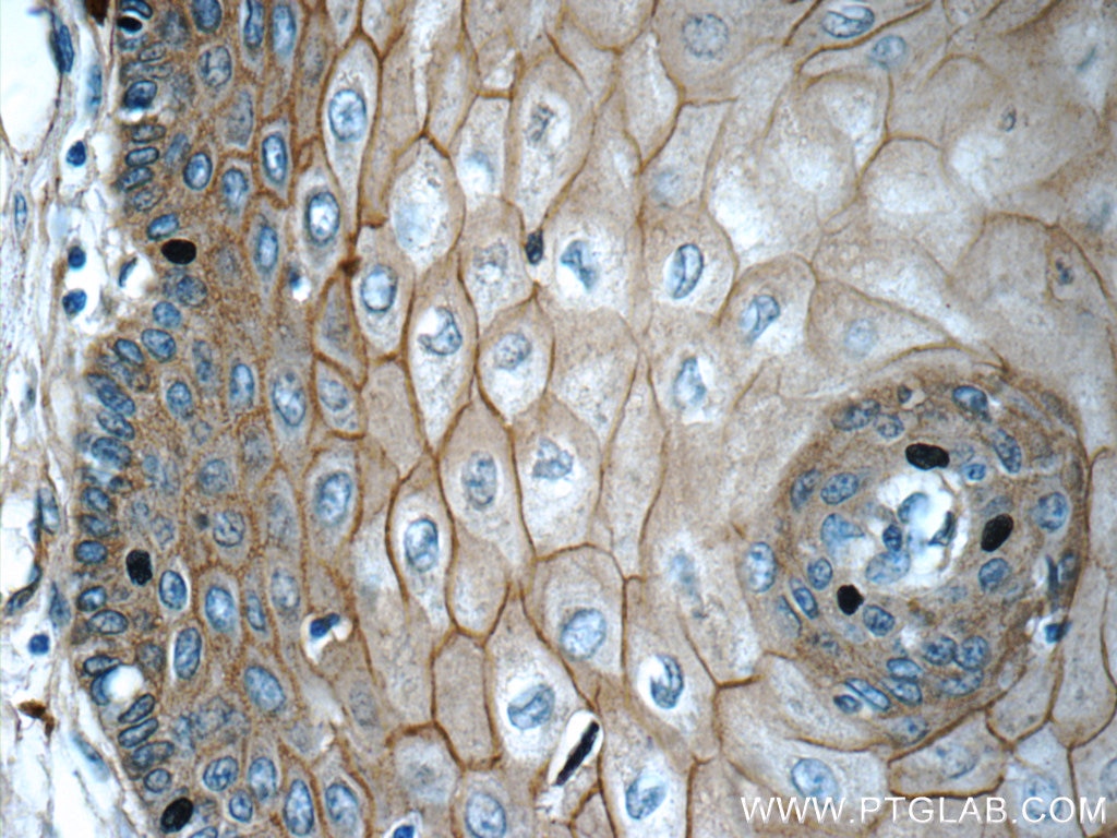GJB6 Polyclonal antibody