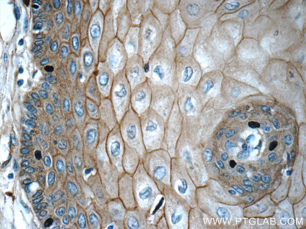 Immunohistochemistry (IHC) staining of human oesophagus tissue using GJB6 Polyclonal antibody (24215-1-AP)