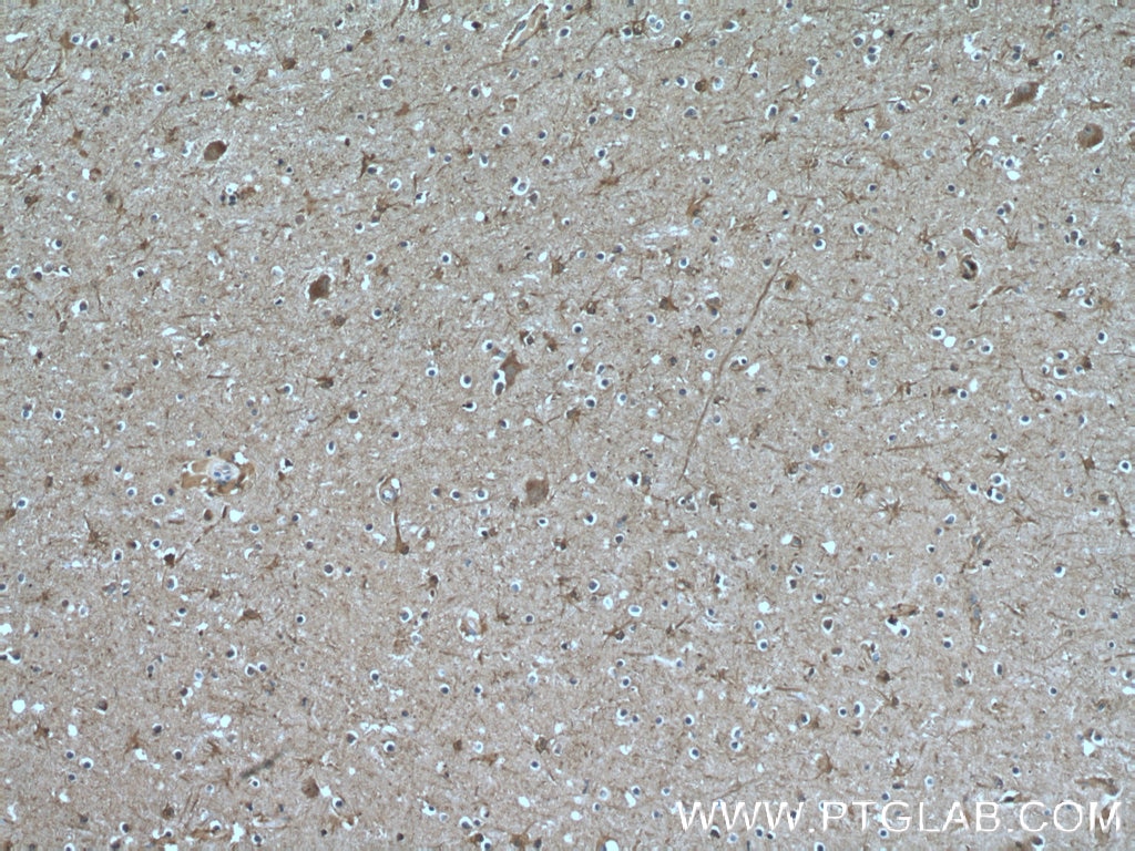 Immunohistochemistry (IHC) staining of human brain tissue using GJC2 Polyclonal antibody (55376-1-AP)