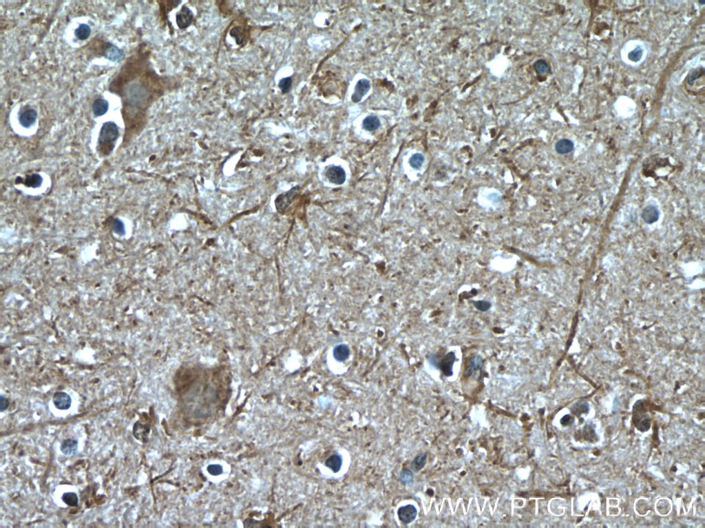 Immunohistochemistry (IHC) staining of human brain tissue using GJC2 Polyclonal antibody (55376-1-AP)