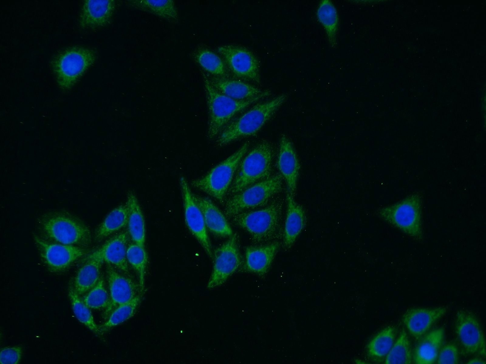 Immunofluorescence (IF) / fluorescent staining of HepG2 cells using Glycerokinase Polyclonal antibody (13360-1-AP)