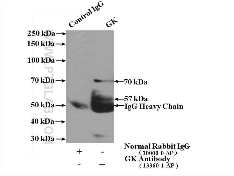 Immunoprecipitation (IP) experiment of HepG2 cells using Glycerokinase Polyclonal antibody (13360-1-AP)