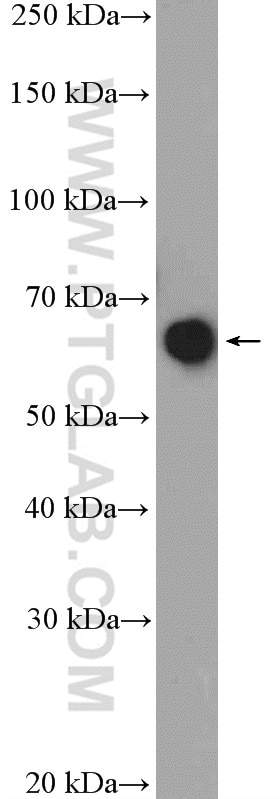 Western Blot (WB) analysis of HepG2 cells using Glycerokinase Polyclonal antibody (13360-1-AP)