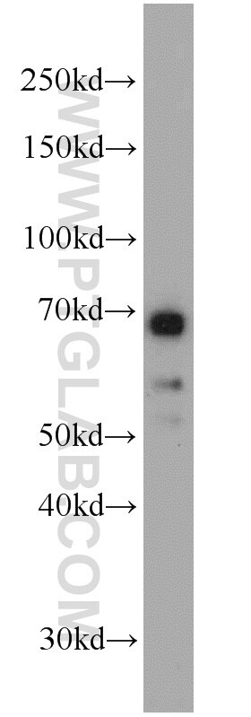 Western Blot (WB) analysis of mouse liver tissue using Glycerokinase Polyclonal antibody (13360-1-AP)