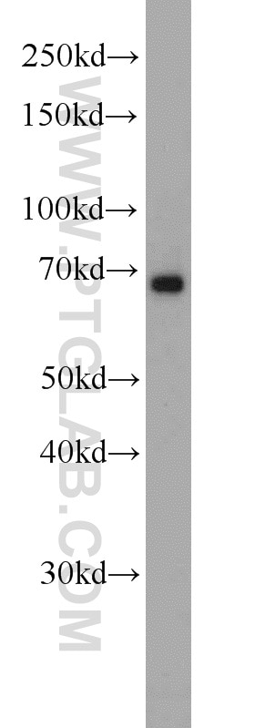 Western Blot (WB) analysis of HepG2 cells using Glycerokinase Polyclonal antibody (13360-1-AP)