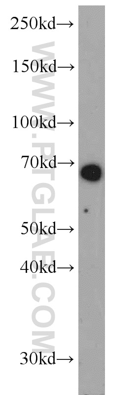 Western Blot (WB) analysis of mouse kidney tissue using Glycerokinase Polyclonal antibody (13360-1-AP)