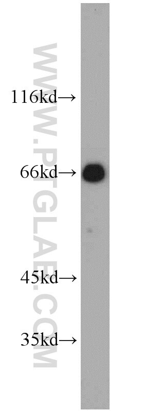 Western Blot (WB) analysis of mouse testis tissue using Glycerokinase Polyclonal antibody (13360-1-AP)