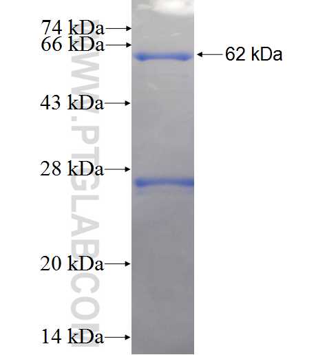 GK fusion protein Ag4175 SDS-PAGE