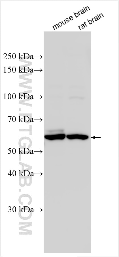 Western Blot (WB) analysis of various lysates using GK2 Polyclonal antibody (12913-1-AP)