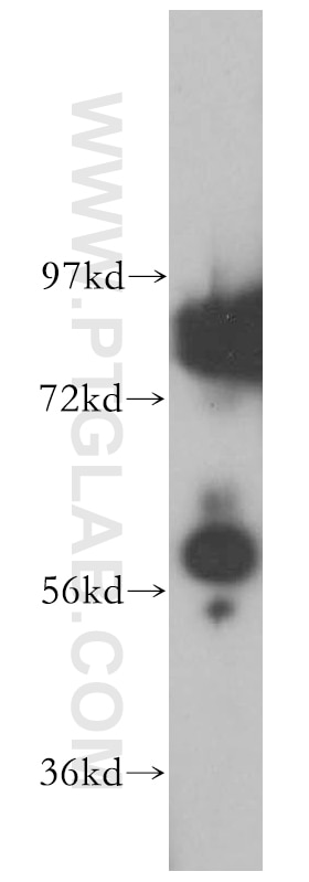 Western Blot (WB) analysis of mouse testis tissue using GK3P Polyclonal antibody (14176-1-AP)