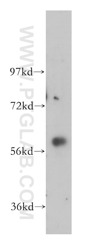 Western Blot (WB) analysis of HeLa cells using GK3P Polyclonal antibody (14176-1-AP)