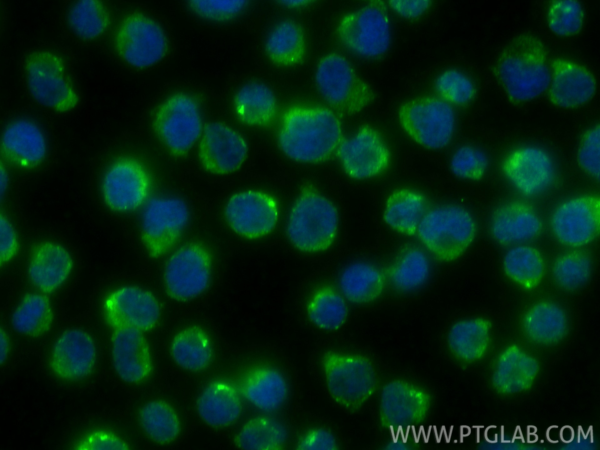 Immunofluorescence (IF) / fluorescent staining of Jurkat cells using GK5 Polyclonal antibody (13457-1-AP)