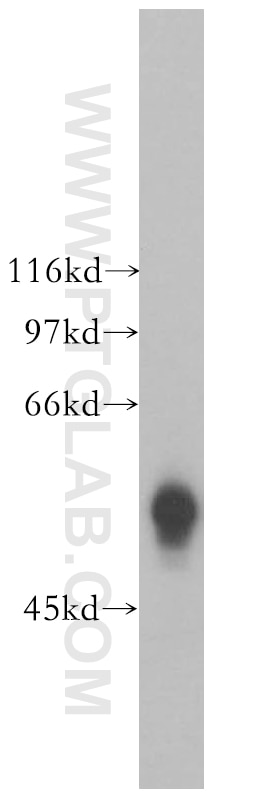 Western Blot (WB) analysis of Jurkat cells using GK5 Polyclonal antibody (13457-1-AP)