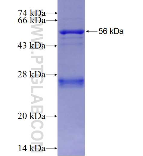 GK5 fusion protein Ag4269 SDS-PAGE